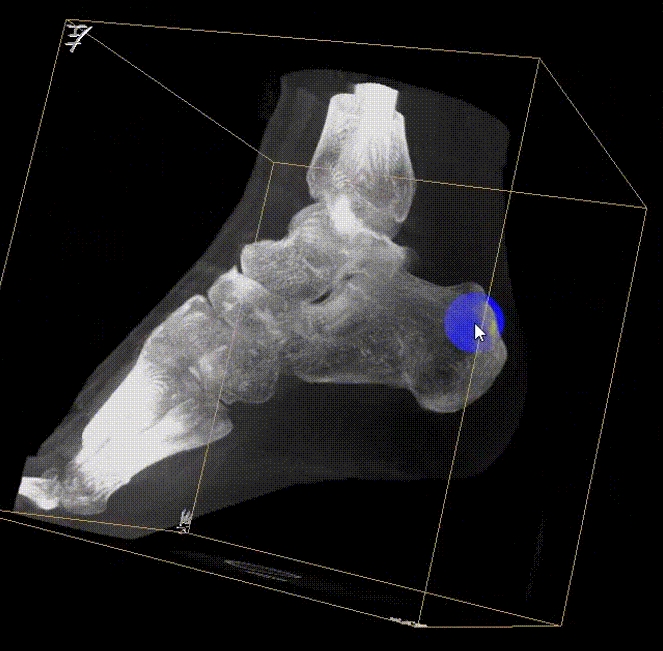 【醫(yī)療科普】:三維影像提高手術(shù)的精度 【醫(yī)療科普】:三維影像提高手術(shù)的精度
