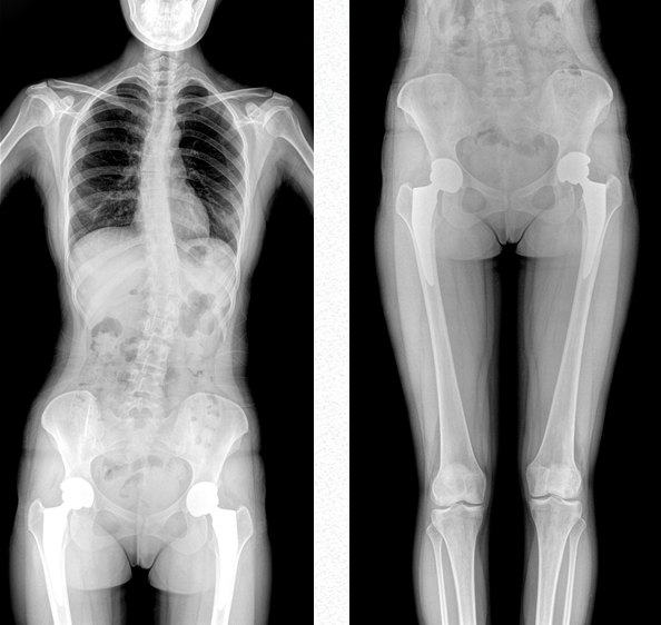 大視野平板動態DR 大視野平板動態DR