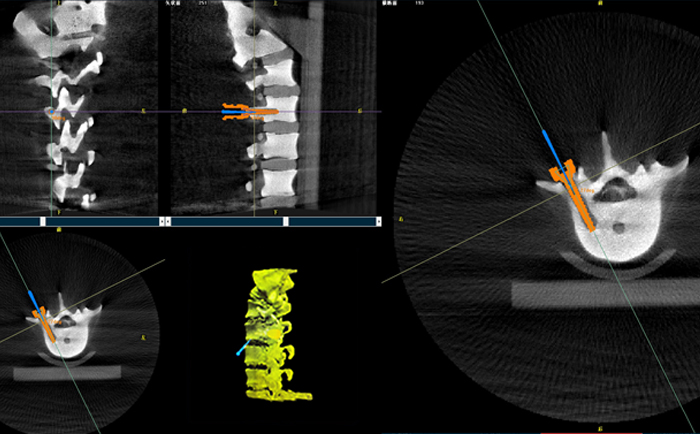 機器人手術(shù)系統(tǒng)3D影像 機器人手術(shù)系統(tǒng)3D影像