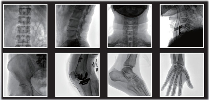 C形臂臨床影像 C形臂臨床影像