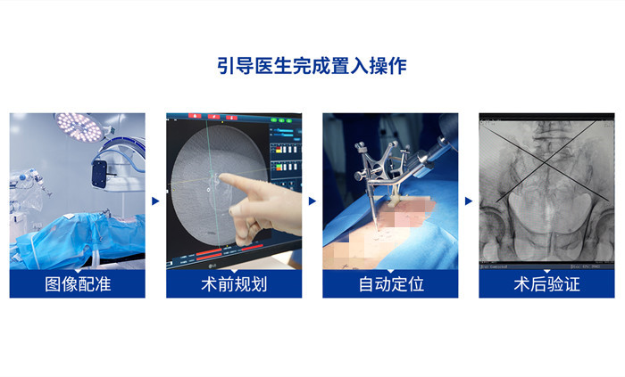 手術機器人優點 手術機器人優點