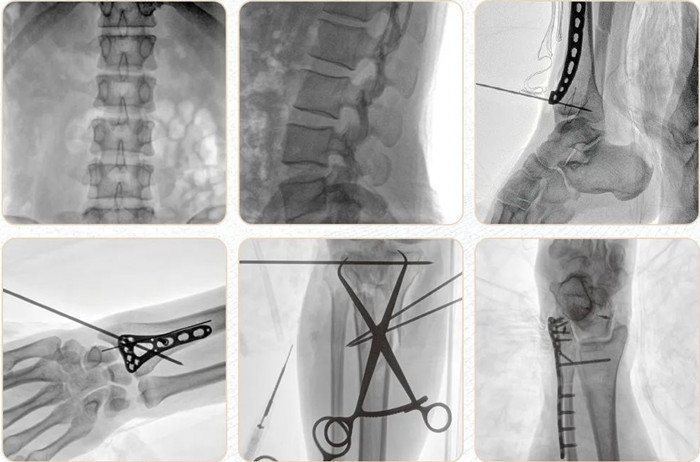 移動式平板C形臂 移動式平板C形臂